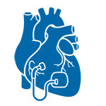 Permanent pacemaker implantation