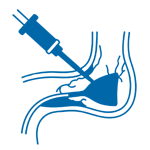 TAVI - Transcatheter aortic valve implantation