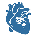 Ventricular septal defect device closure